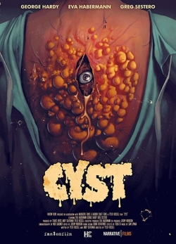 watch-Cyst
